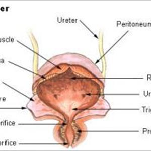 Strong Smelling Urine Information - The Most Effective Home Remedies For Urinary Tract Infection - 3 Cures To Kill Urinary Infections