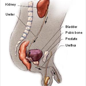 Treatment Urinary Tract Infection Men - How To Prevent A UTI